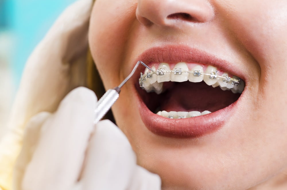 The importance of an excellent orthodontic professional