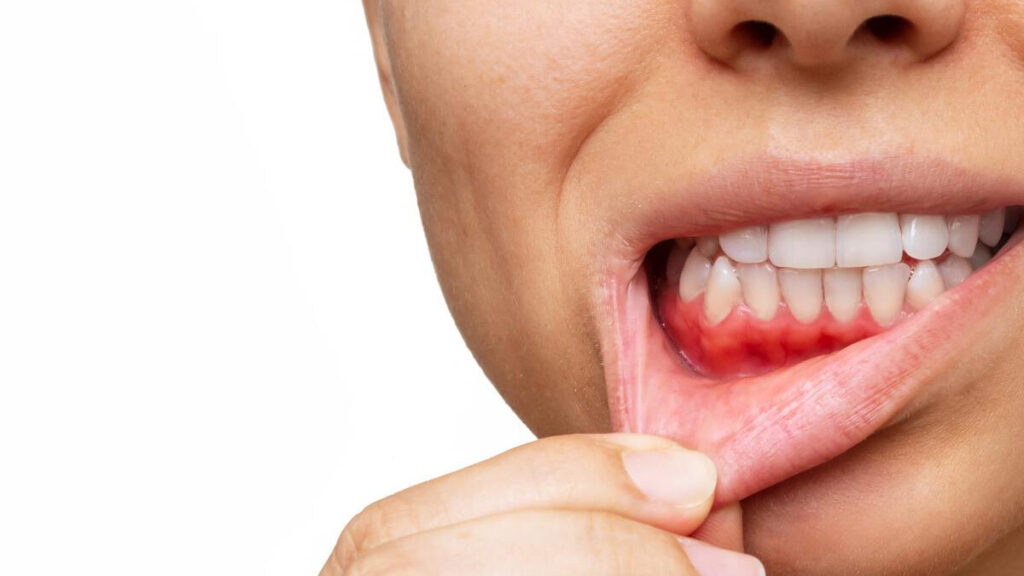 Signs You May Need To See A Periodontist