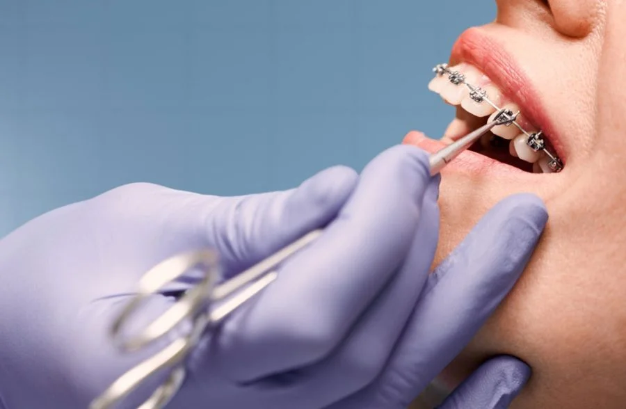 The Connection Between Orthodontics And Facial Symmetry